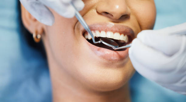 Best Emergency Treatment for Dental Infections or Abscesses in Prince George, VA